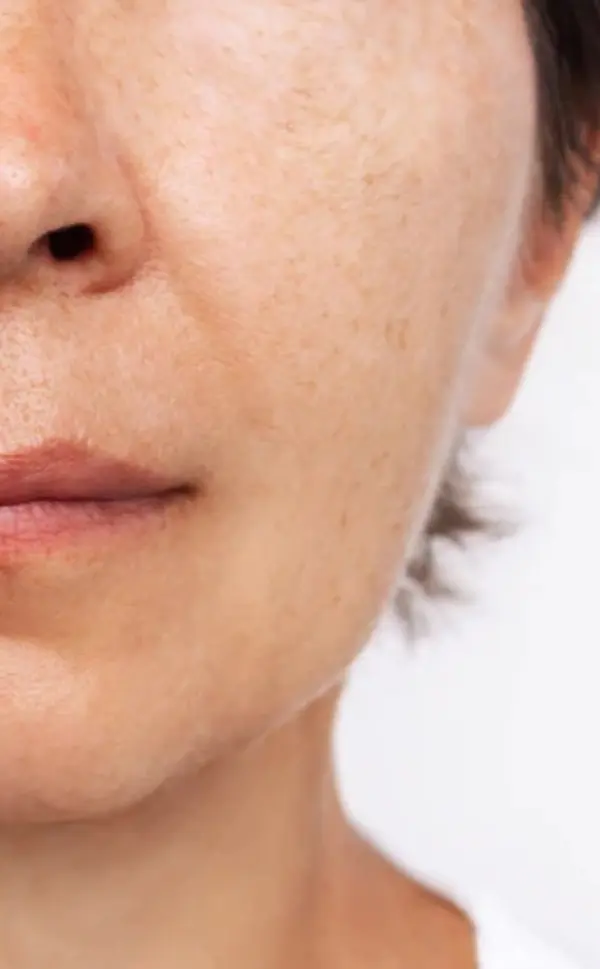 After 21 days of treatment