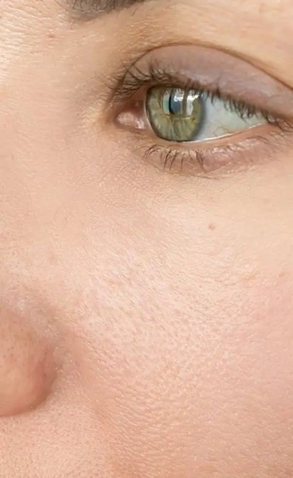 After 21 days of treatment